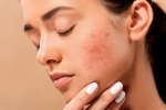 home remedies, skin care products, 10 ways to get rid of pimples at home, Cleaning